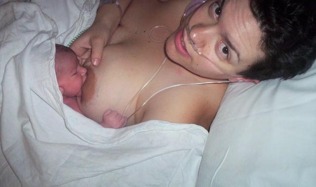 Breastfeeding shop after surgery